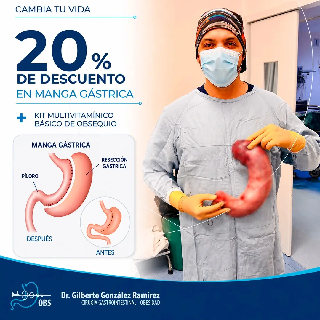 Manga gástrica con hasta 30% de descuento